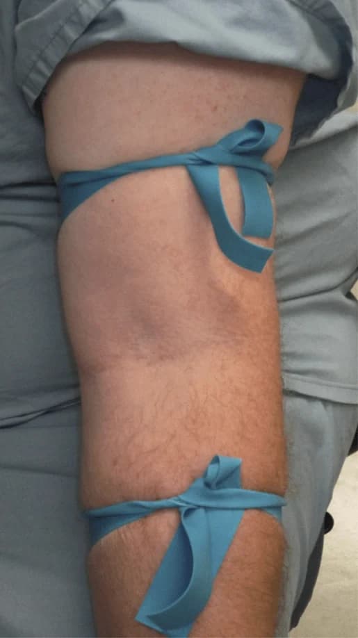 High-precision anatomical illustration of a human thigh in coronal cross-section showing two CAT Gen 7 windlass tourniquets applied circumferentially. Semi-translucent tissues reveal the rectus femoris, vastus lateralis, profunda femoris artery and vascular structures, with inward compression arrows and an occluded vessel segment indicated by labeled callouts.